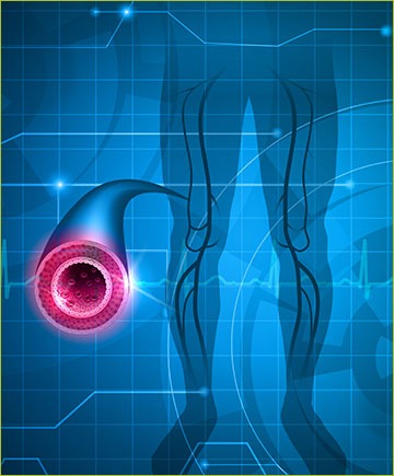 Illustration of Arteries